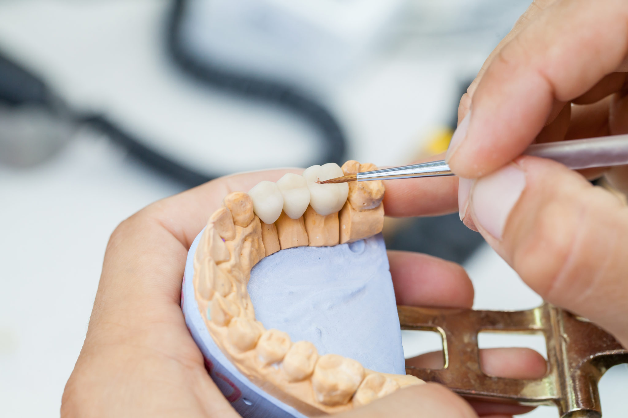 Services Ceramics Dental Lab North Miami Beach