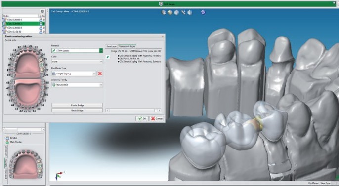 Straumann Cares Visual Validated Workflow Ceramics Dental Lab